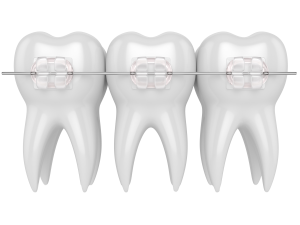 3-dientes-1-300x225